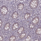 Anti-NUDT16 Antibody