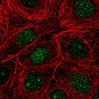 Immunofluorescent staining of human cell line MCF7 shows localization to nucleus & nucleoli.