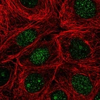 Immunofluorescent staining of human cell line MCF7 shows localization to nucleus & nucleoli.