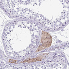 Anti-VSIG10L Antibody