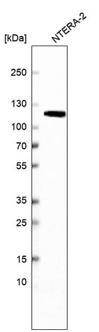 Anti-MSH2 Antibody