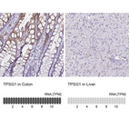 Anti-TPSG1 Antibody