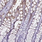 Immunohistochemical staining of human colon shows high expression.