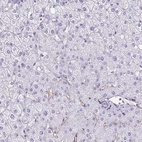Immunohistochemical staining of human liver shows low expression as expected.