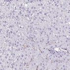 Anti-TPSG1 Antibody