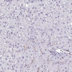 Immunohistochemical staining of human liver shows low expression as expected.