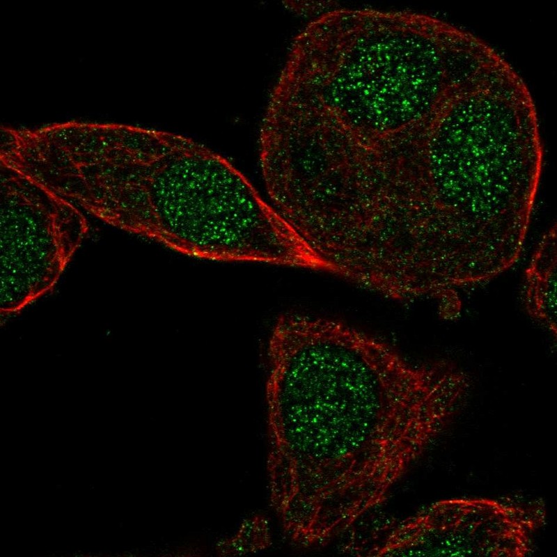 Anti-CYB5RL Antibody