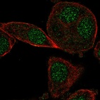 Anti-CYB5RL Antibody