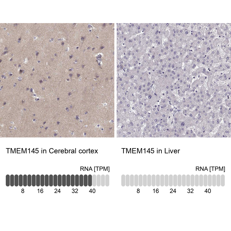 Anti-TMEM145 Antibody