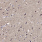 Immunohistochemical staining of human cerebral cortex shows high expression.