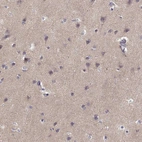 Immunohistochemical staining of human cerebral cortex shows moderate cytoplasmic positivity in neuropil.