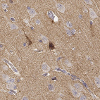 Immunohistochemical staining of human cerebral cortex shows strong cytoplasmic positivity in a subset of neurons.