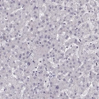 Immunohistochemical staining of human liver shows no positivity in hepatocytes, as expected.