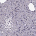 Anti-TMEM145 Antibody