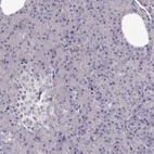 Immunohistochemical staining of human pancreas shows low expression as expected.