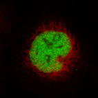 Anti-MSH2 Antibody