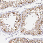 Anti-COL28A1 Antibody