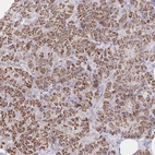 Immunohistochemical staining of human pancreas shows strong cytoplasmic positivity in exocrine glandular cells.