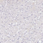 Immunohistochemical staining of human liver shows no positivity in hepatocytes as expected.