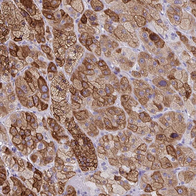 Anti-ZFP82 Antibody