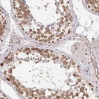 Anti-CLASRP Antibody