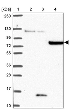Lane 1: Marker [kDa] 250, 130, 95, 72, 55, 36, 28, 17, 10_br/_Lane 2: Human cell line RT-4_br/_Lane 3: Human cell line U-251MG sp_br/_Lane 4: Human plasma (IgG/HSA depleted)
