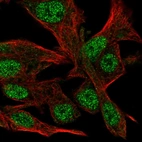 Immunofluorescent staining of human cell line Hep G2 shows localization to nucleoplasm.