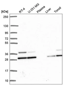 Anti-PGAM1 Antibody