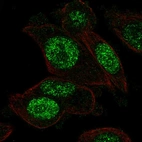 Immunofluorescent staining of human cell line PC-3 shows localization to nucleoplasm.