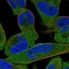 Immunofluorescent staining of human cell line RH-30 shows localization to cytosol.