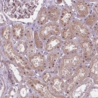Anti-RND3 Antibody