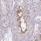 Anti-SLC30A3 Antibody