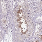 Immunohistochemical staining of human testis shows moderate cytoplasmic positivity in cells in seminiferous ducts.