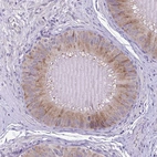 Immunohistochemical staining of human epididymis shows moderate cytoplasmic positivity in glandular cells.