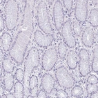 Immunohistochemical staining of human stomach shows no positivity in glandular cells as expected.