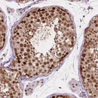 Immunohistochemical staining of human testis shows strong nuclear positivity in cells in seminiferous ducts.