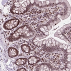 Immunohistochemical staining of human small intestine shows strong nuclear positivity in glandular cells.