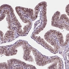 Immunohistochemical staining of human fallopian tube shows moderate nuclear positivity in glandular cells.