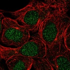 Anti-USP3 Antibody