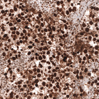 Anti-MSH2 Antibody