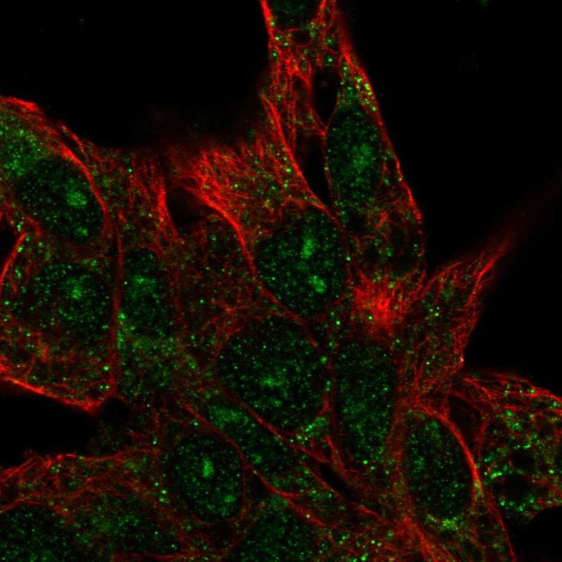 Anti-CENPBD1 Antibody
