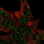Anti-CENPBD1 Antibody