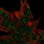 Anti-CENPBD1 Antibody