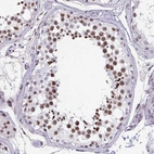 Immunohistochemical staining of human testis shows high expression.