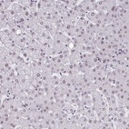 Anti-CBFA2T2 Antibody