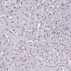 Immunohistochemical staining of human liver shows low expression as expected.