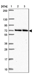 Lane 1: Marker [kDa] 250, 130, 95, 72, 55, 36, 28, 17, 10_br/_Lane 2: Human cell line RT-4_br/_Lane 3: Human cell line U-251MG sp