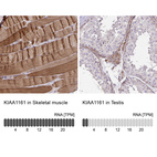 Anti-KIAA1161 Antibody