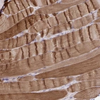 Immunohistochemical staining of human skeletal muscle shows strong cytoplasmic positivity in myocytes.