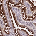 Immunohistochemical staining of human small intestine shows strong cytoplasmic positivity in glandular cells.